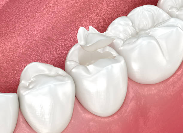 Our Range of Dental Services in Glendale, WI